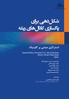 شکل دهی برای پاکسازی کانال های ریشه استراتژی مبتنی بر کلینیک 2022